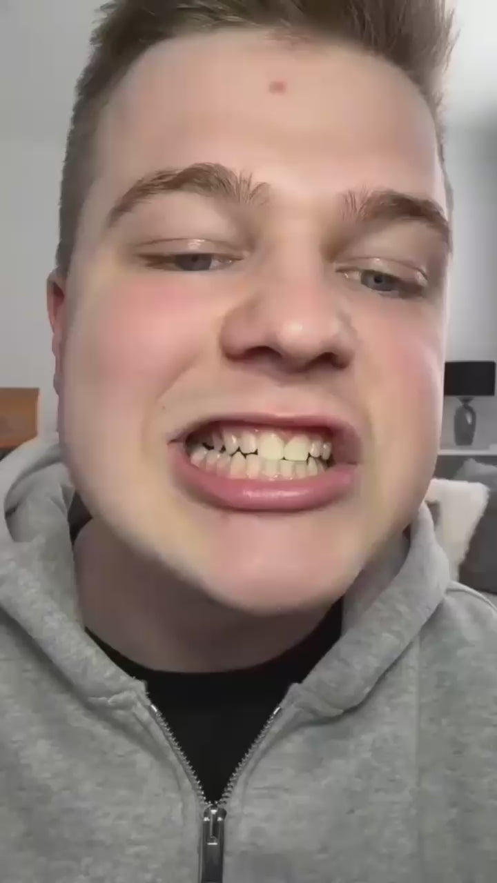 Vidéo